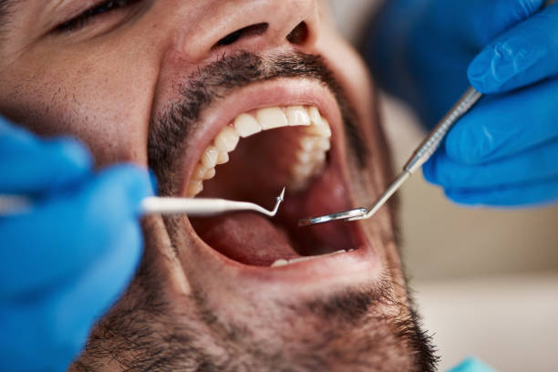 Best Urgent Tooth Repair  in Logan Elm Village, OH